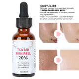 TCA Skin Peel 20% - Melao 30ml - Masks n More 